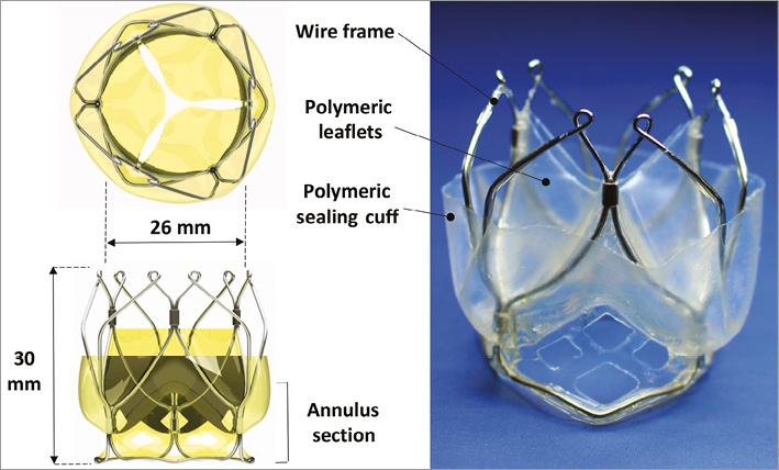 A new transcatheter heart valve concept (the TRISKELE): feasibility in ...