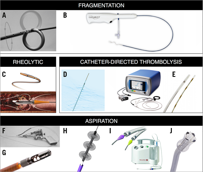 Catheterbased therapies in acute pulmonary embolism EuroIntervention