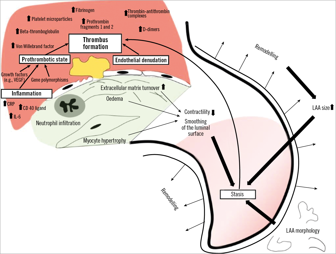 Ehra Eapci Expert Consensus Statement On Catheter Based Left Atrial Appendage Occlusion An Update Eurointervention