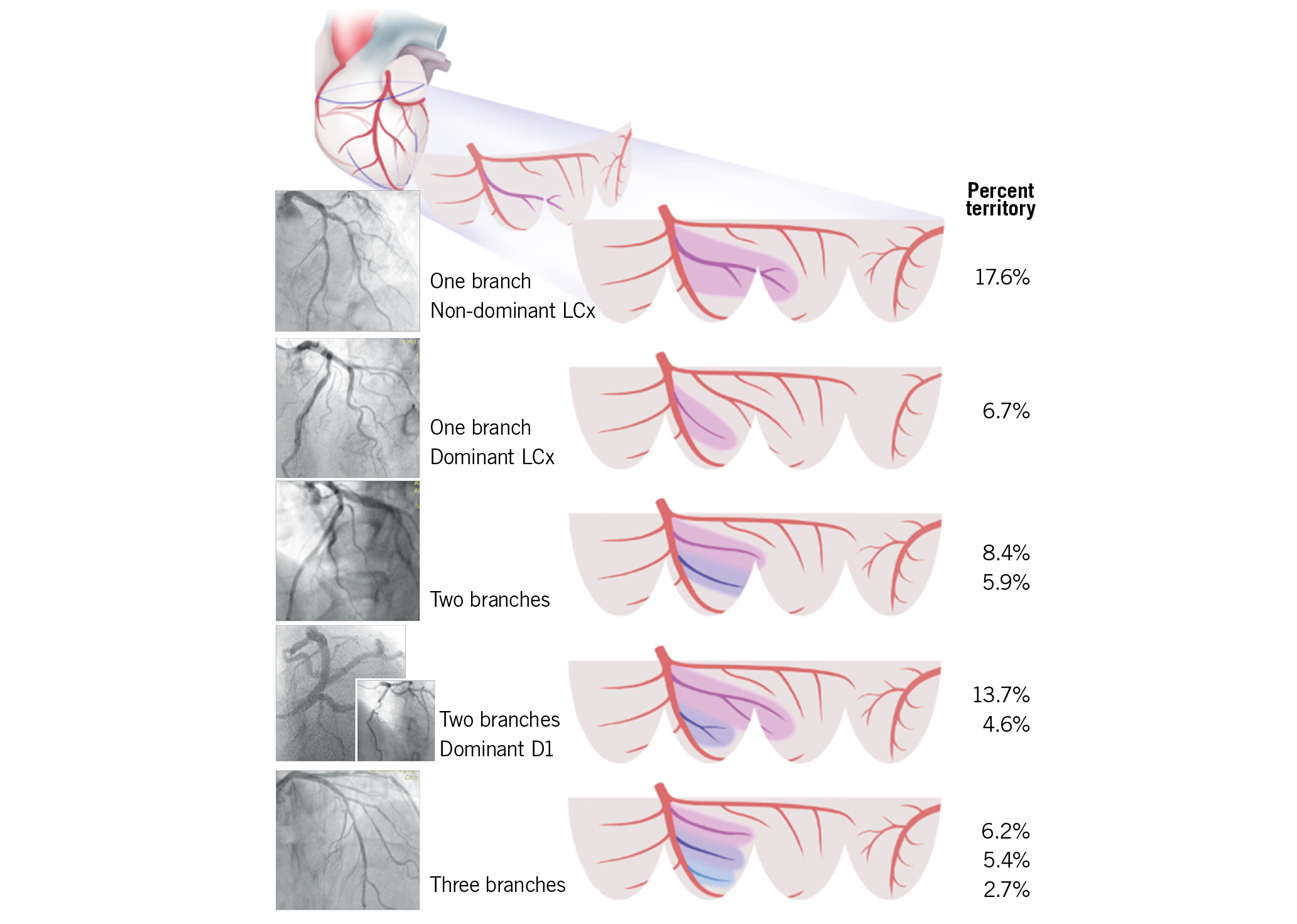 Number Of Diagonal Arteries / Posterior Interventricular Artery An ...