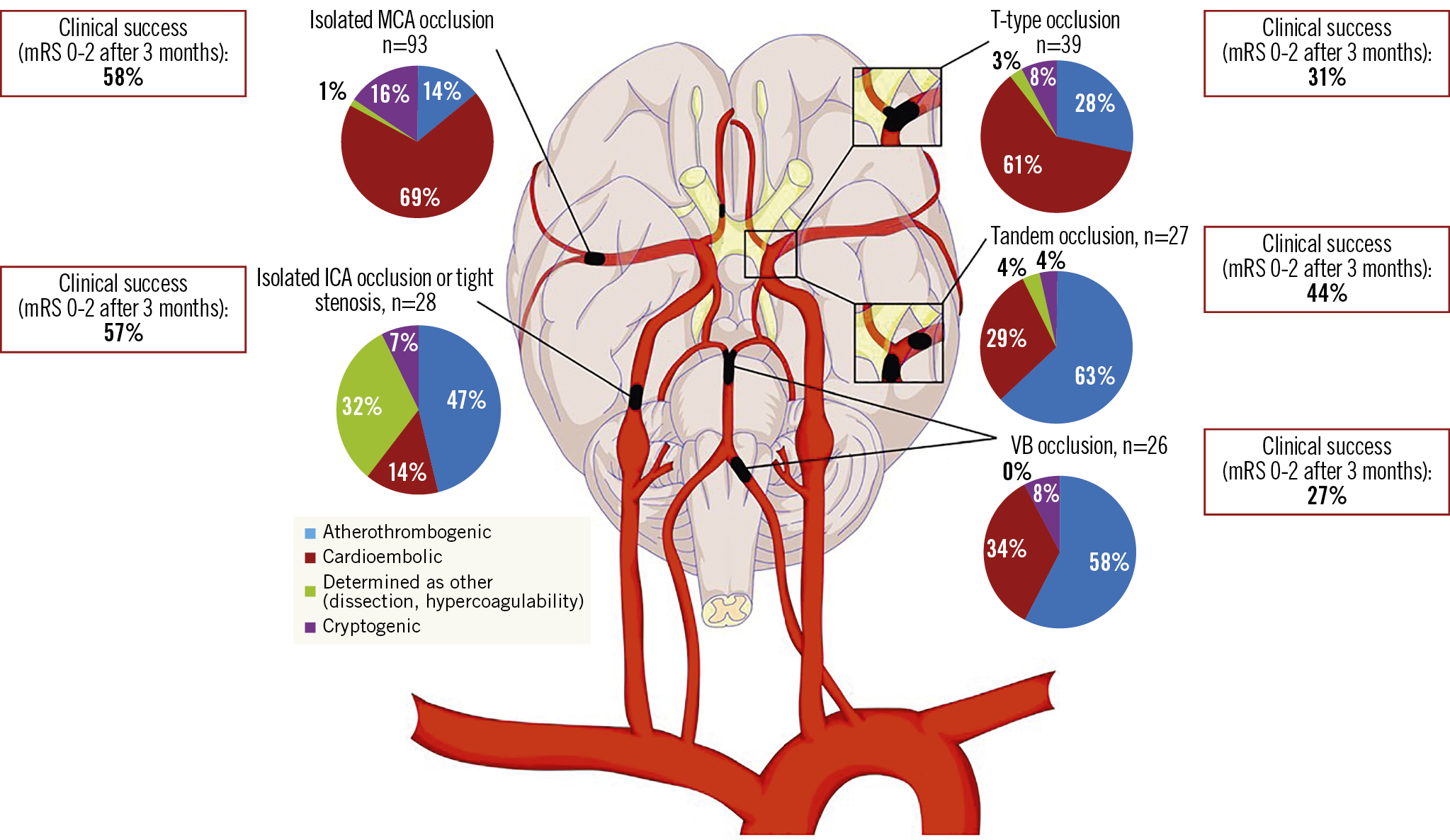 Long Term Outcomes Of Thrombectomy For Acute Ischaemic Stroke By Occluded Artery And Stroke Aetiology A Prague 16 Substudy Eurointervention X Mol