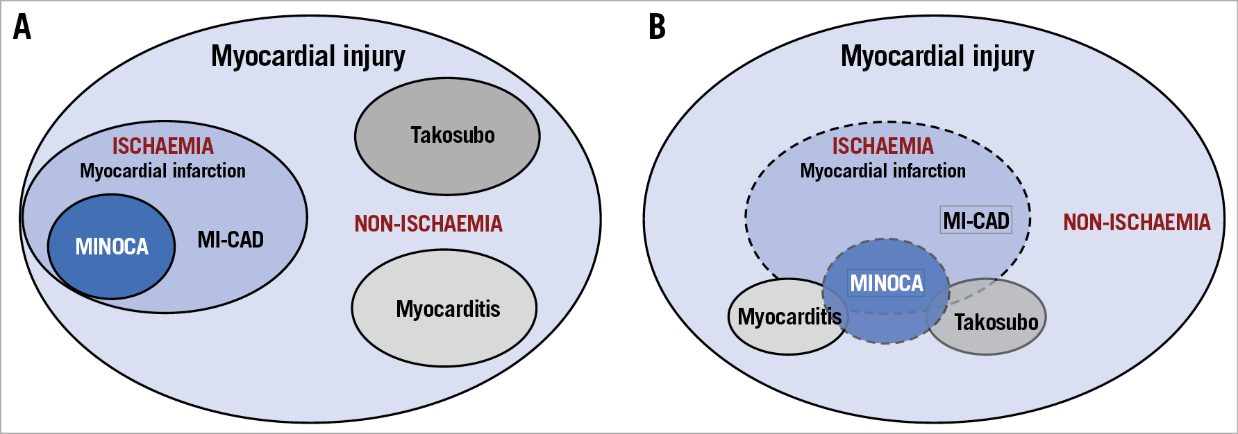 Homogenous, clear-cut, 3-h-old lesion of transmural coagulation