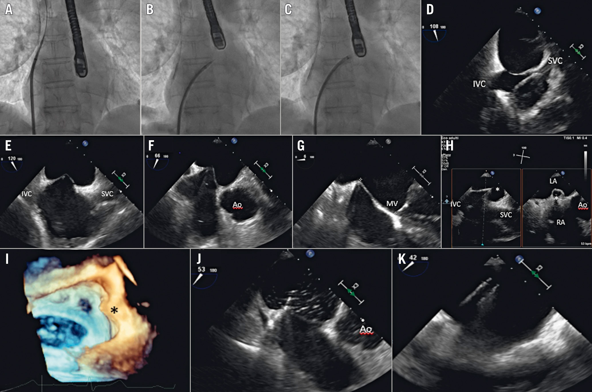 Ten basic TEE views for the practical test with anatomic structures