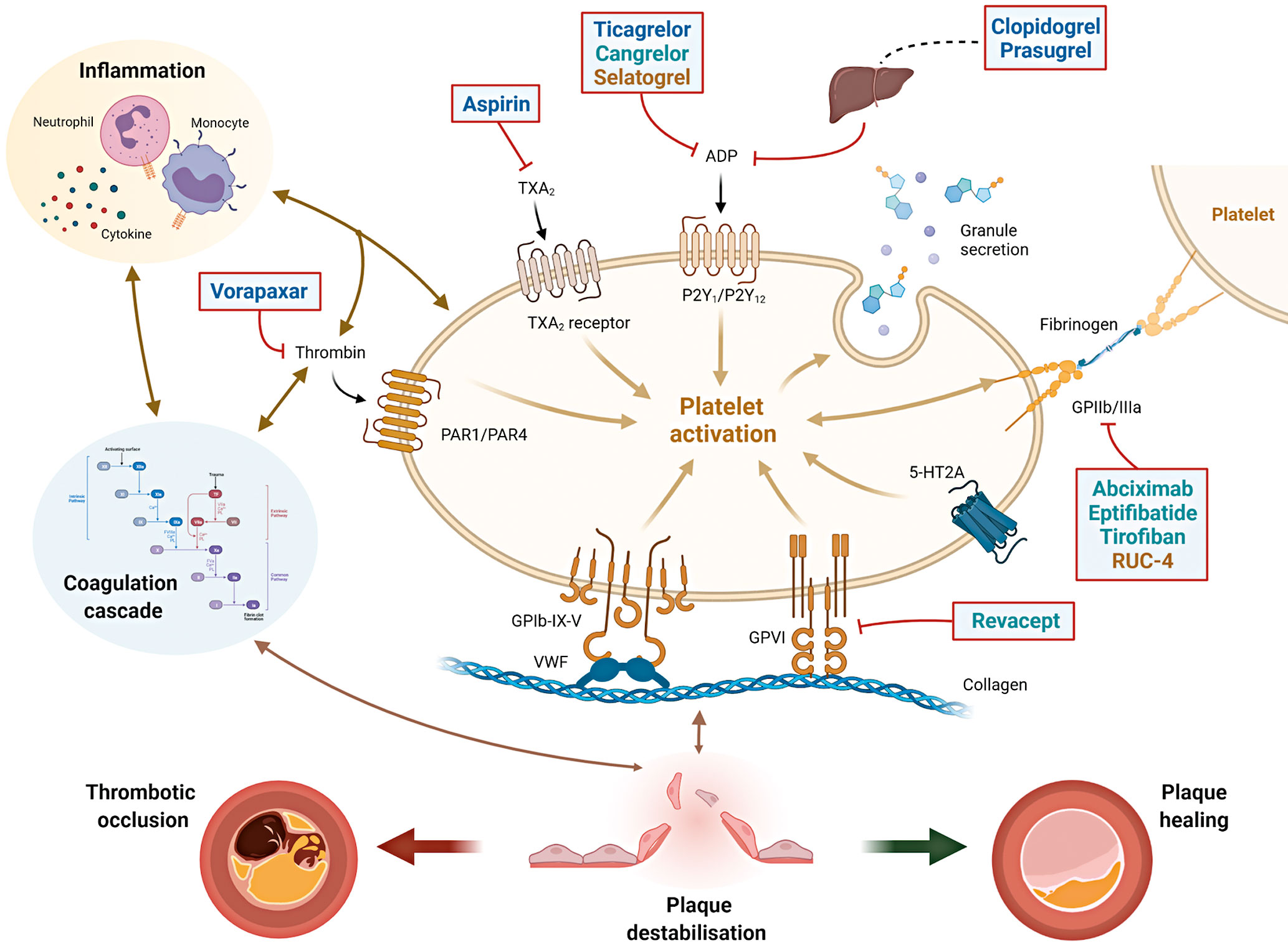 Where Do Potent P2Y12 Inhibitors Fit Into Current Practice? - Acute  Coronary Syndrome (ACS)