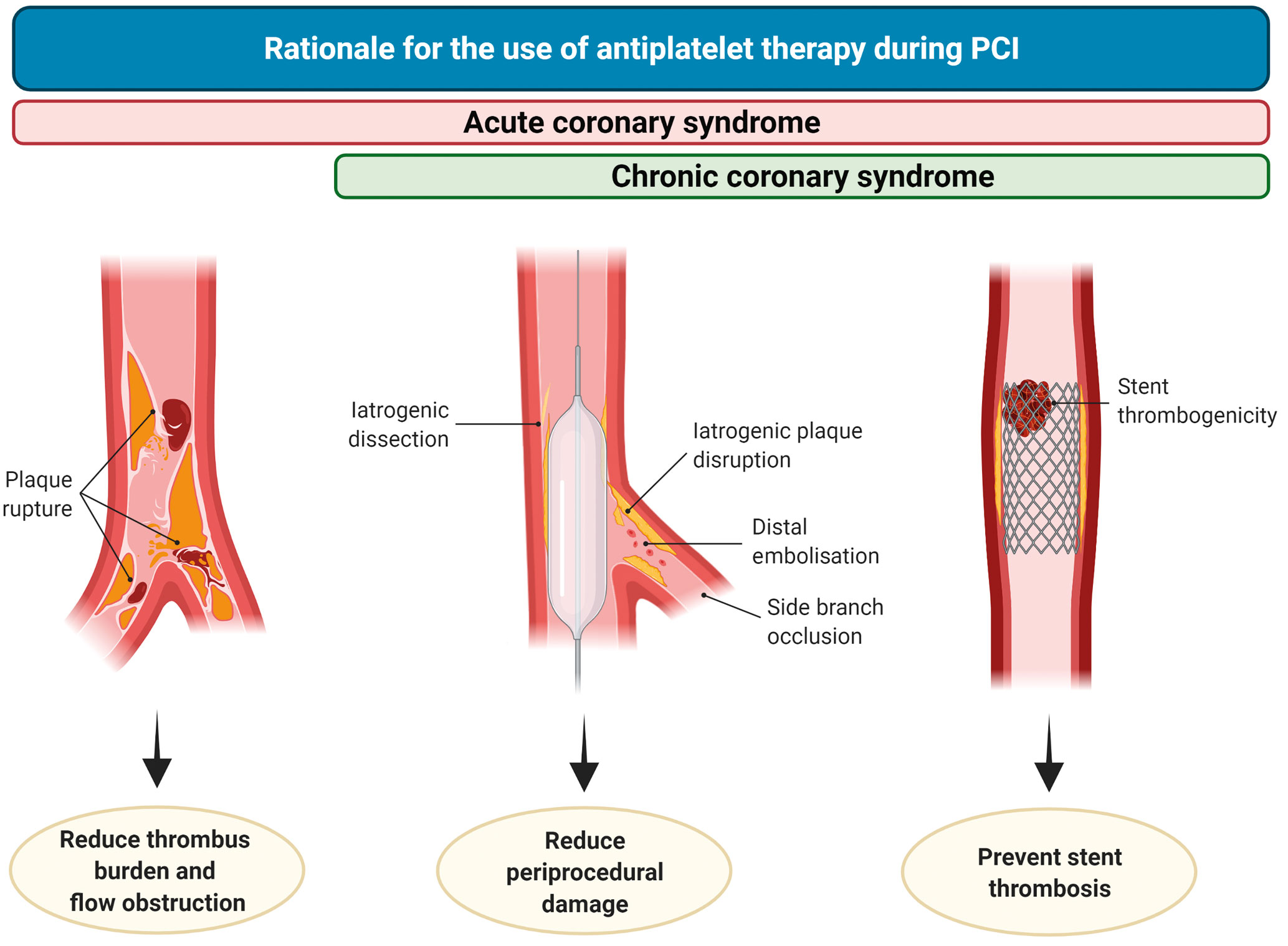 Where Do Potent P2Y12 Inhibitors Fit Into Current Practice? - Acute  Coronary Syndrome (ACS)