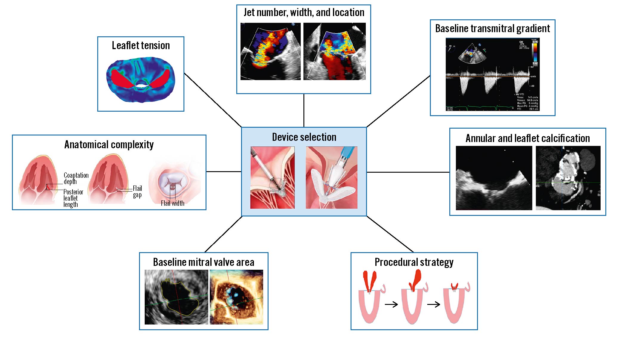 FDA Advisors' Recommendation on Renal Denervation Hinges on