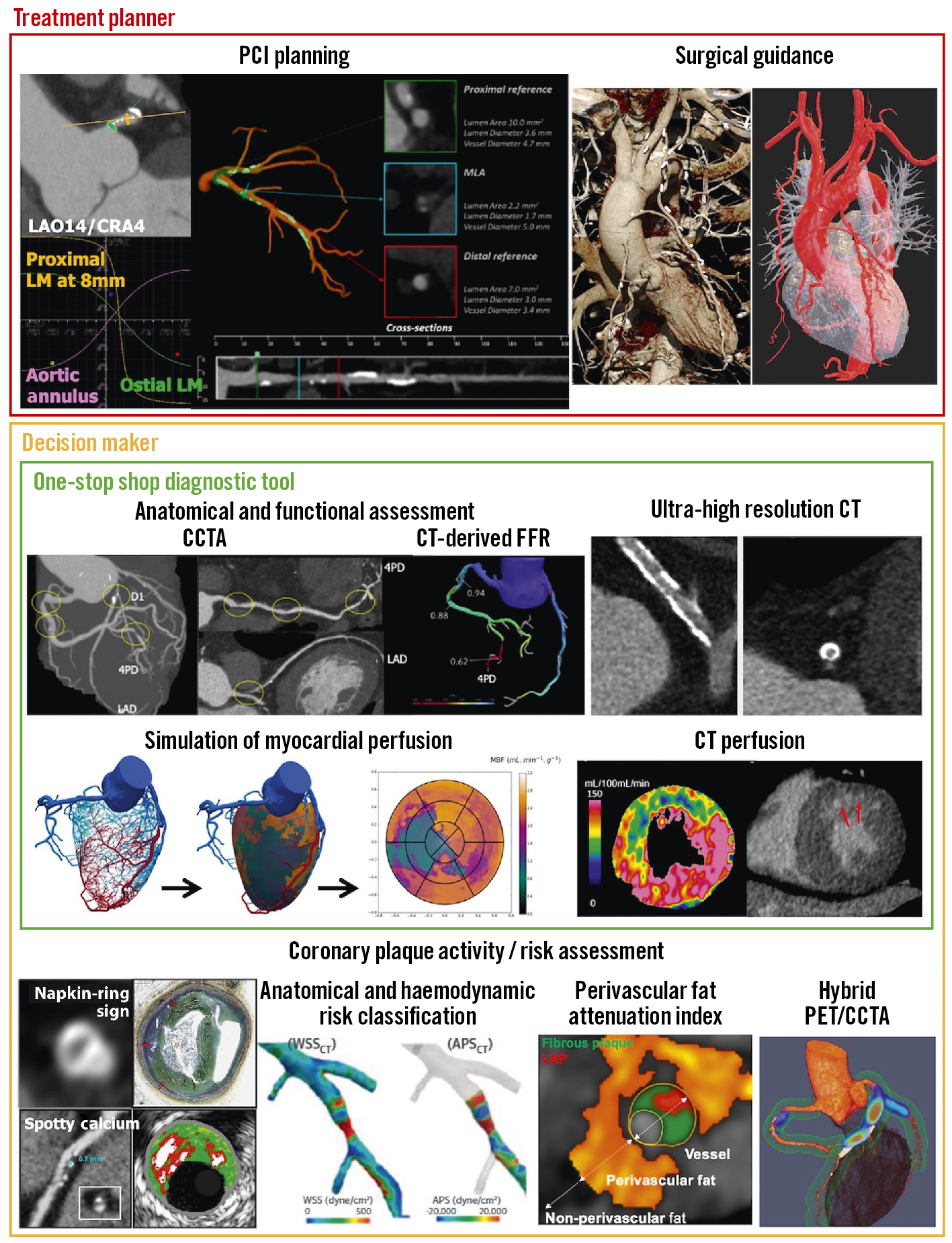 Contrast Media with and without Calcium for Cardioangiography in